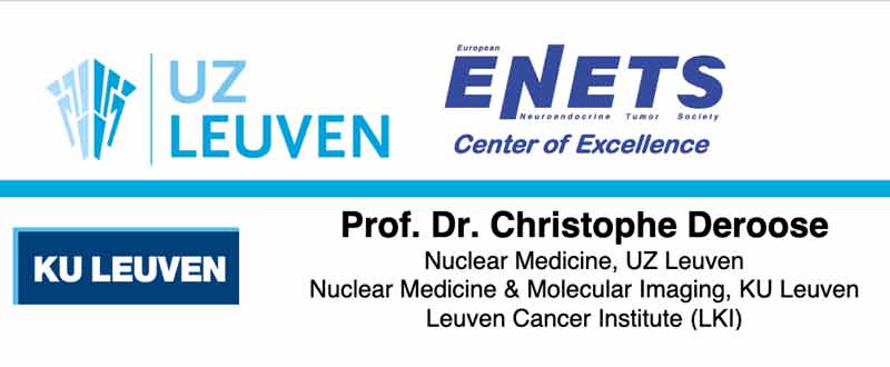 UZ Leuven is het oudste ENETS Center of Excellence voor neuroendocriene tumoren in België
